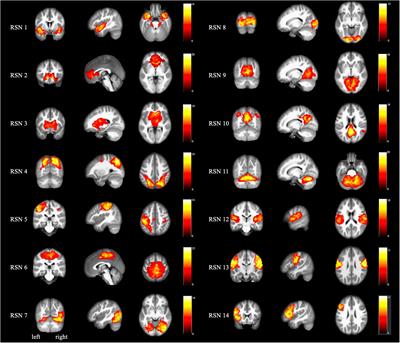 Intra and inter: Alterations in functional brain resting-state networks in patients with functional constipation